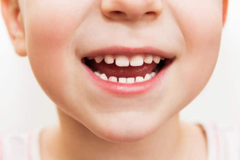 Close up of a child's teeth.